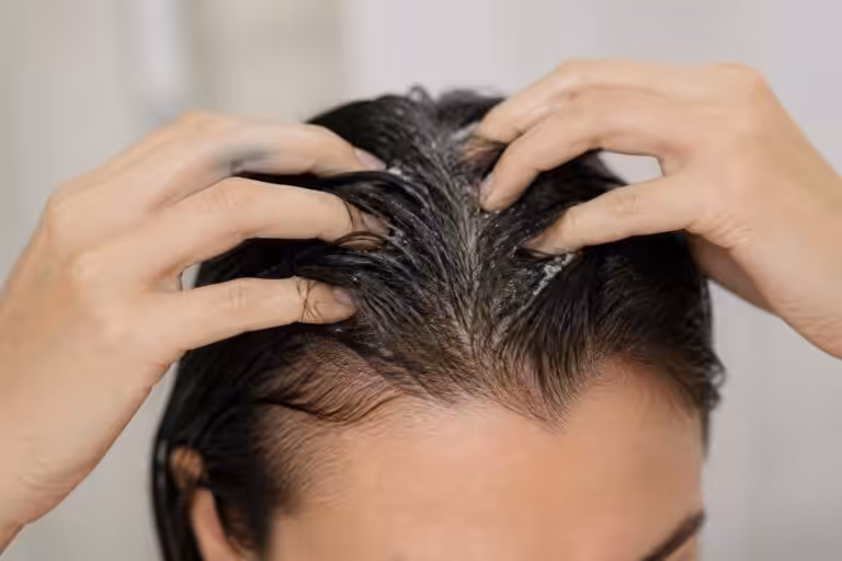 découvrez quand faire un gommage du cuir chevelu : avant ou après le shampoing, pour un cuir chevelu sain et des cheveux revitalisés.